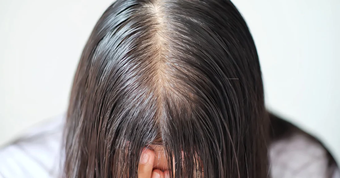 Penjagaan Rambut Wanita Berhijab: Pentingnya Rambut Sehat dan Cara ...