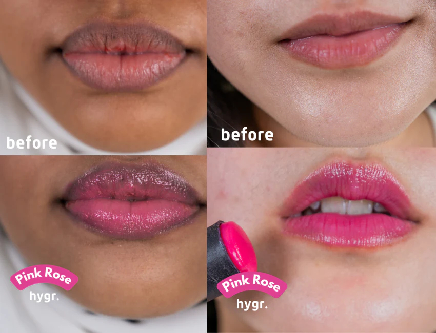 Contoh Bibir Yang Hitam Dan Kering