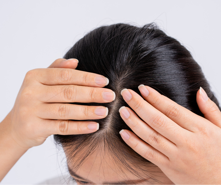 Rambut berminyak, fokus pada hujung rambut. Rambut kering/rosak mendapat manfaat kelembapan minyak.