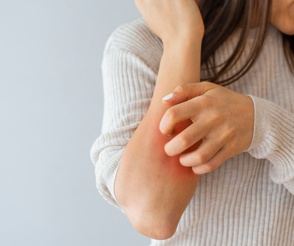 Sabun jenis ini kadang-kadang boleh mencetuskan keadaan dermatitis sentuhan, menyebabkan penampilan ruam merah dan gatal-gatal pada kulit.