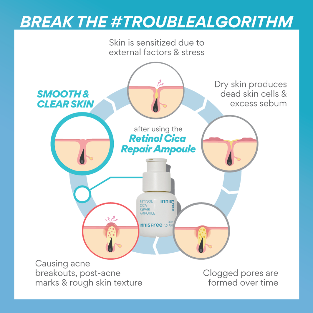 INNISFREE akan bantu korang pecahkan #TroubleAlgorithm yang menghantui hidup korang