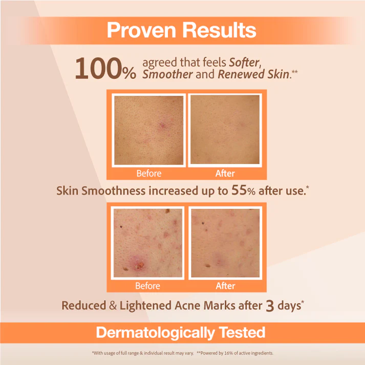 Dalam masa 3 hari kulit anda ternyata lebih lembut