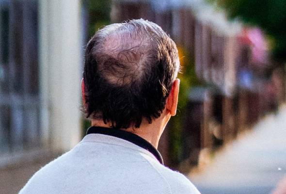 Kesalahan mencuci boleh menyebabkan keguguran rambut!